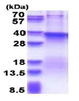 Ab180311  Sds Page Img42149
