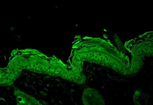 Hsp90 Antibody Ab13495  Immunohistochemistry Formalin Pfa Fixed Paraffin Embedded Sections Img8846