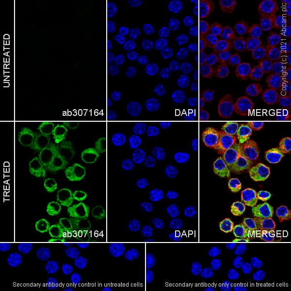 Anti-TNF alpha antibody [RM1005](AB307164)