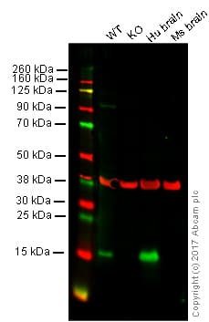 Anti-Alpha-synuclein antibody [MJFR1](AB138501)