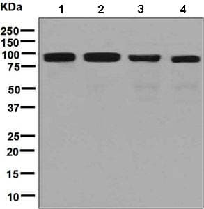 Anti-Activin Receptor Type IIA/ACVR2A antibody [EPR7407](AB134082)