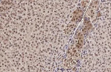 Anti-KMT3A / HYPB / HIF-1 antibody(AB184190)