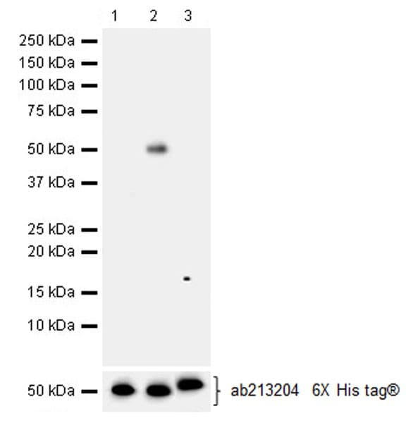 Anti-Hexokinase II antibody [EPR20839](AB209847)