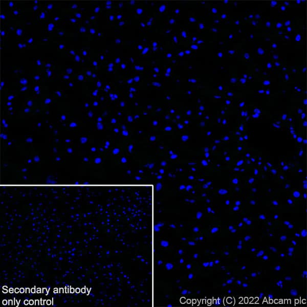 Anti-Nav1.8/SCN10A antibody [EPR25132-222](AB307817)