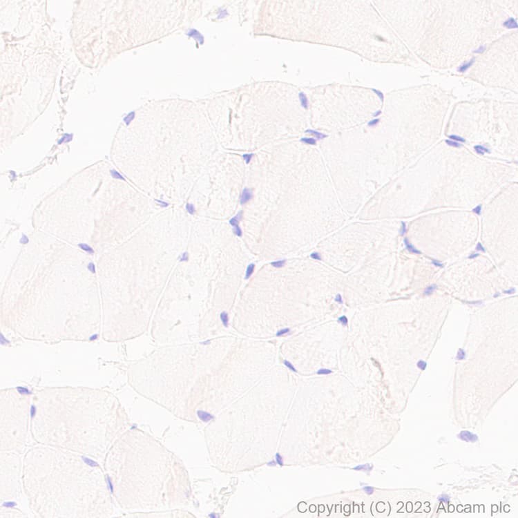 Anti-VSV-G tag antibody [EPR28362-204](AB309106)