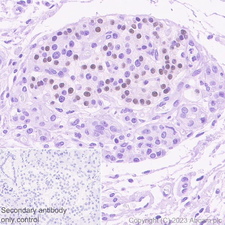 Arx Antibody Epr27481 32 Ab308260  Immunohistochemistry Formalin Pfa Fixed Paraffin Embedded Sections Img408866
