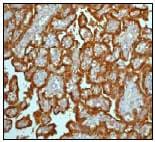 Hsd17b1 Antibody Ep1682y Bsa And Azide Free Ab247308  Immunohistochemistry Formalin Pfa Fixed Paraffin Embedded Sections Img57083