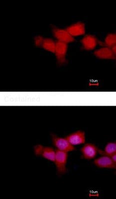 Anti-OTUD6B antibody(AB127714)