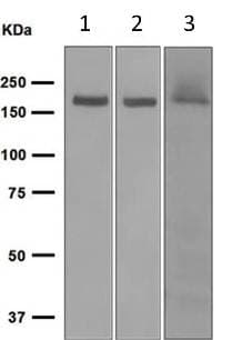 Anti-NMDAR2A antibody [EPR2465(2)](AB124913)