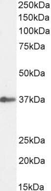 Siah1 Antibody Ab2237  Western Blot Img403705