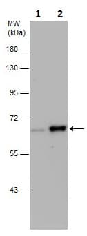 Anti-Chk2 (phospho T68) antibody(AB226984)