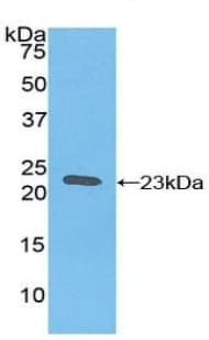 Anti-Ferritin Heavy Chain antibody(AB231253)