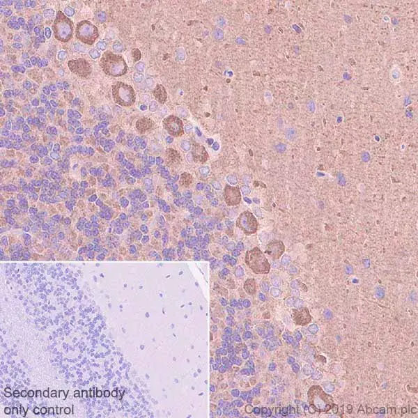 Anti-non-muscle Myosin IIB/MYH10 antibody [EPR22564-23](AB230823)