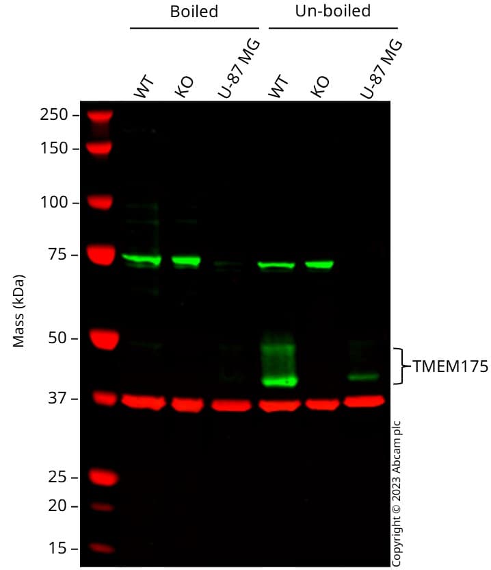 Tmem175 Antibody Epr24415 47 Ab300457  Western Blot Img416707