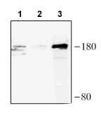 Anti-CRISPR-Cas9 antibody(AB204448)