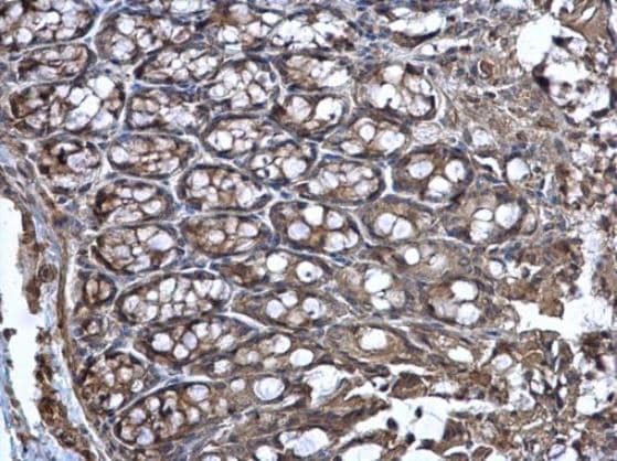 Wnt11 Antibody Ab96730  Immunohistochemistry Formalin Pfa Fixed Paraffin Embedded Sections Img46248