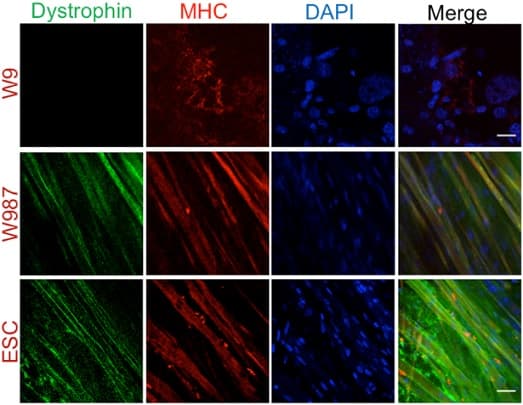 Anti-Dystrophin antibody(AB15277)