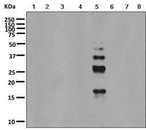 Anti-Ubiquitin (linkage-specific K48) antibody [EP8589](AB140601)