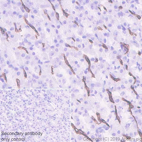 Anti-CD36 antibody [EPR22509-40](ab252922)