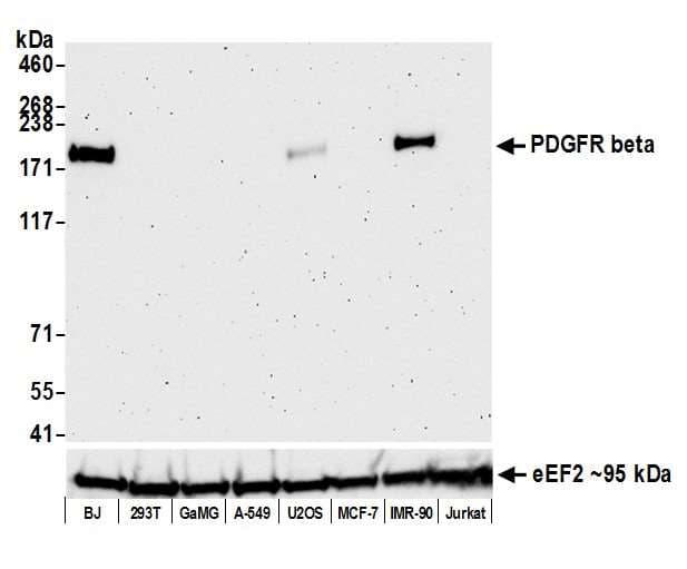 Anti-PDGFR beta antibody [BLR081G] - BSA free(AB314096)