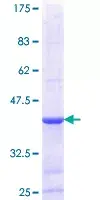 Recombinant Human DGAT2 protein(AB153553)