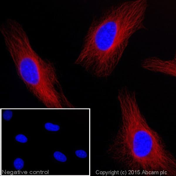 Goat Anti-Rat IgG H&L (Alexa Fluor® 647)(AB150159)