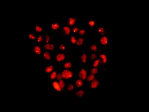 Anti-53BP1 antibody [EPR2172(2)](AB175933)