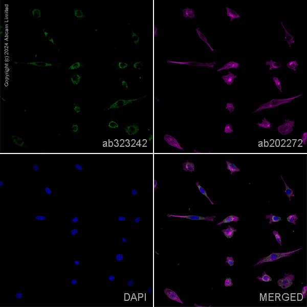 Alexa Fluor 594 Alpha Tubulin Antibody Ep1332y Microtubule Marker Ab202272  Immunocytochemistry Immunofluorescence Img440846
