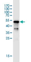 Anti-MHC Class II antibody [6C6](AB55152)