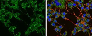 Anti-Tyrosine Hydroxylase antibody(AB137721)
