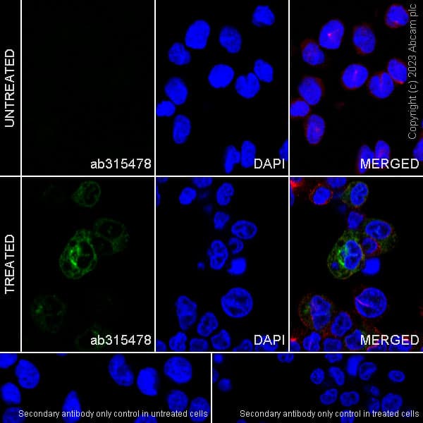 Anti-MCP1 antibody [RM1100](AB315478)