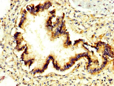 Prune Antibody Ab237518  Immunohistochemistry Formalin Pfa Fixed Paraffin Embedded Sections Img23121