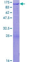 Recombinant Human HIRIP3 protein(AB132409)