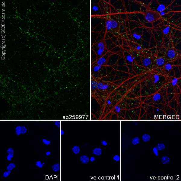 Anti-SYT2 + SYT1 antibody [EPR23920-2](AB259977)