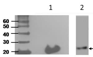 Interferon Gamma Antibody N3 P3a5a10 Ab211784  Western Blot Img103958