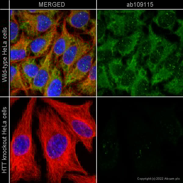 Anti-Huntingtin antibody [EPR5526](AB109115)
