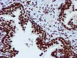 Anti-PADI4 / PAD4 antibody [OTI4H5](AB128086)