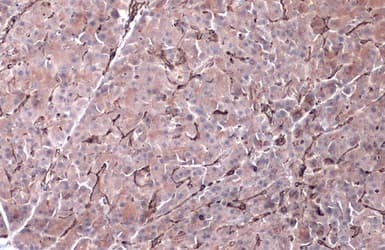 Anti-Vimentin antibody(AB137321)