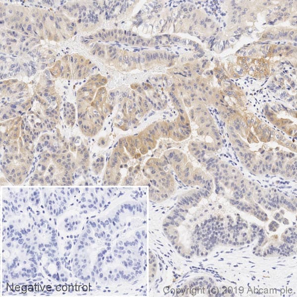 HRP Anti-Hexokinase II antibody [EPR20839](AB237315)