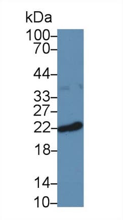 Anti-Ferritin Heavy Chain antibody(AB231253)