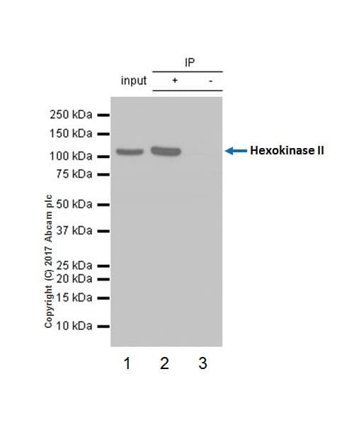 Anti-Hexokinase II antibody [EPR20839](AB209847)