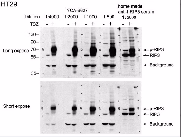 Rip3 Phospho S227 Antibody Epr9627 Ab209384 Western Blot Img109251