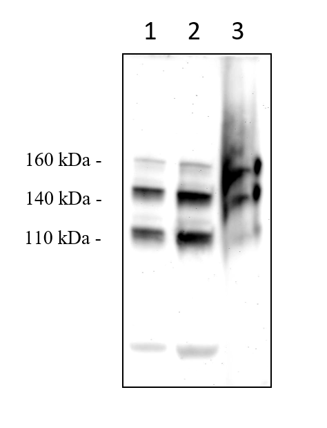 Anti-LDL Receptor antibody(AB30532)