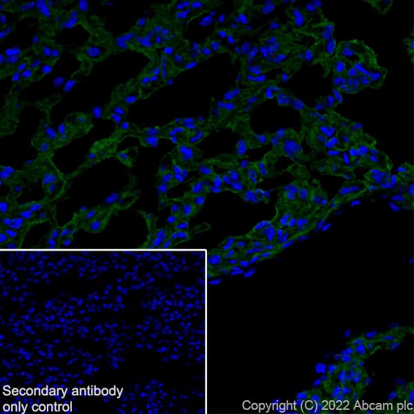 Anti-Aquaporin 5 antibody [EPR27474-70] - BSA and Azide free(AB305304)