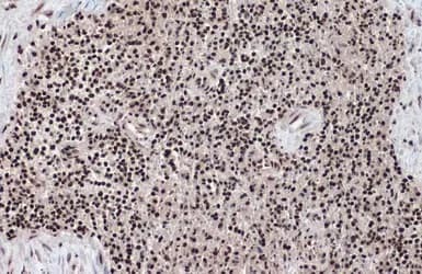 Anti-Histone H2A.Z antibody - ChIP Grade(ab97966)