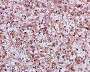 Skp2 Antibody Epr33052 Bsa And Azide Free Ab240263  Immunohistochemistry Formalin Pfa Fixed Paraffin Embedded Sections Img107210