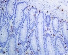 Anti-Mast Cell Tryptase antibody [EPR9522] - Low endotoxin, Azide free(AB216451)