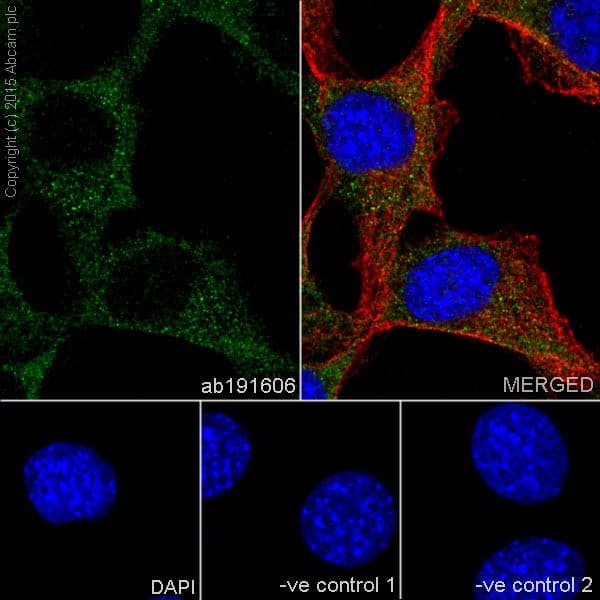 Anti-PI 3 Kinase p85 alpha antibody [EPR18702](AB191606)