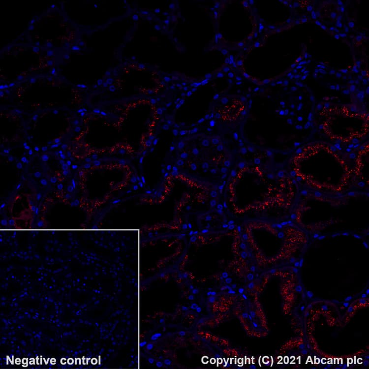 Alexa Fluor® 594 Anti-Osteopontin antibody [EPR21139-316](AB282279)