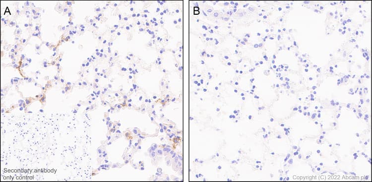 Anti-IL-6 antibody [EPR23819-103](AB290735)